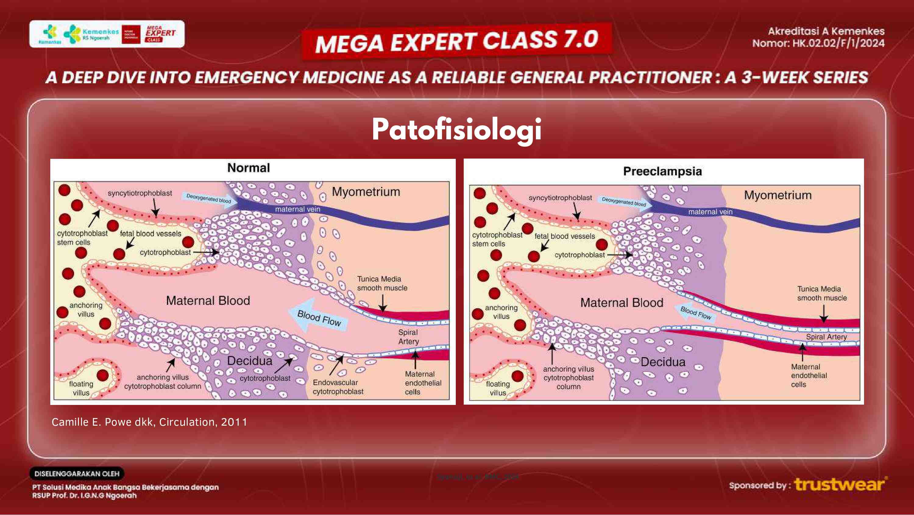 [week-2]-obstetric-emergencies-managing-preeclampsia-and-labor-complications-464
